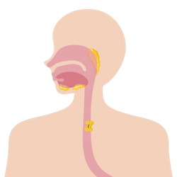 Esophageal Cancer