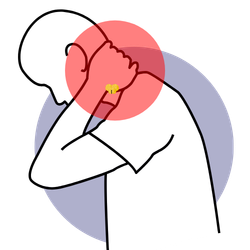 Head and Neck Cancer